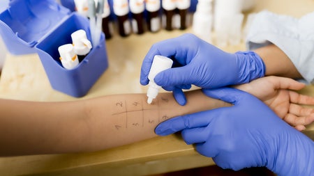 Jeder Sechste betroffen: Warum Pollenallergien immer häufiger werden – und was hilft