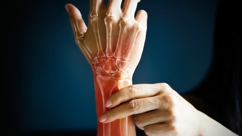 Schluss mit Mausarm: Mit diesen Handübungen beugst du RSI effektiv vor!