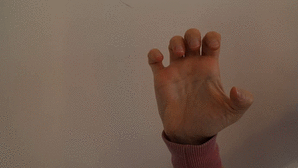 rsi-repetitive-strain-injury-mausarm-1