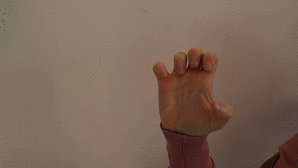 rsi-repetitive-strain-injury-mausarm-2