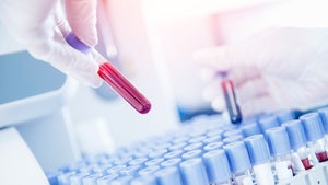 Beunruhigende Ergebnisse: Mikroplastik in der Luft könnte Krebs verursachen