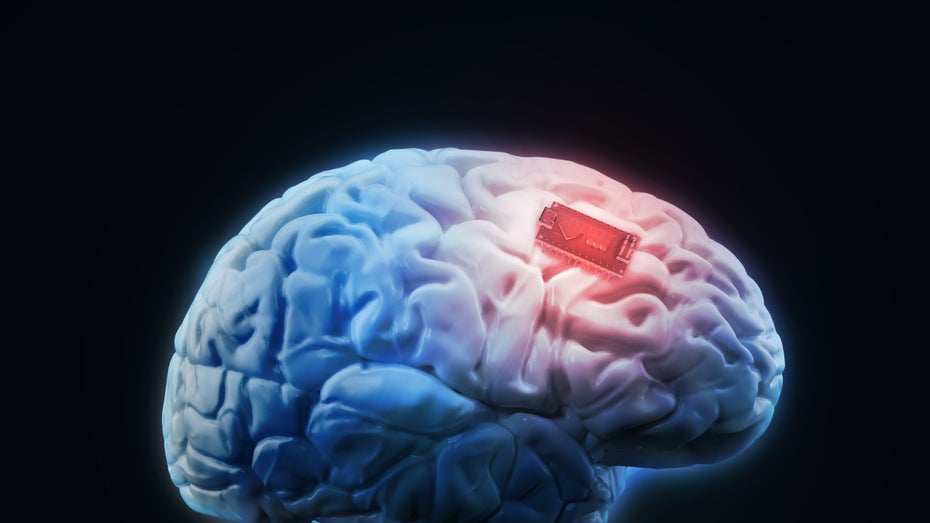 Gehirnimplantate geben, drahtlos verbunden mit einem Computer außerhalb des Körpers, interessant Einblick in das menschliche Gehirn. (Symbolbild: Shutterstock/Mopic) Gedanken sichtbar machen: Wie Neurowissenschaftler die elektrische Aktivität im Gehirn visualisieren
