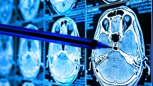 Durchbruch: Röntgenaufnahme eines einzigen Atoms