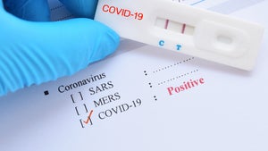 Coronatest positiv: 12 Prozent der Deutschen gehen trotzdem zur Arbeit
