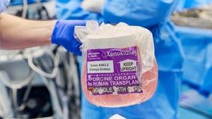Xenotransplantation geht voran: Dritter Mensch erhält geneditierte Schweineniere