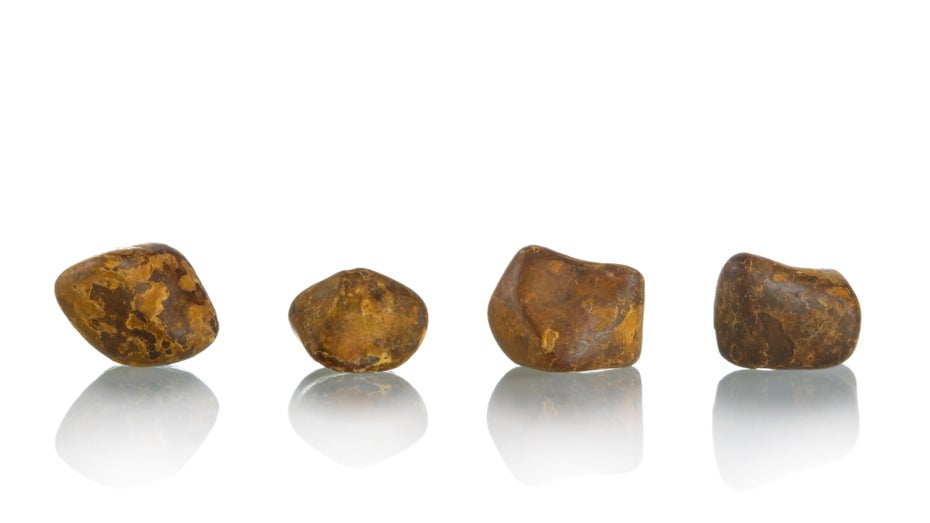 Erbsenkleine Schätze: Warum Gallensteine von Rindern doppelt so viel wert sind wie Gold