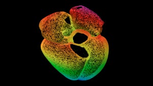 Der Weg zum digitalen Herz: Für neue Therapien wollen Mediziner alle Organe virtuell nachbilden Der Weg zum digitalen Herz: Für neue Therapien wollen Mediziner alle Organe virtuell nachbilden