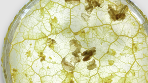 Was uns Schleimpilze darüber lehren können, bessere Städte zu bauen