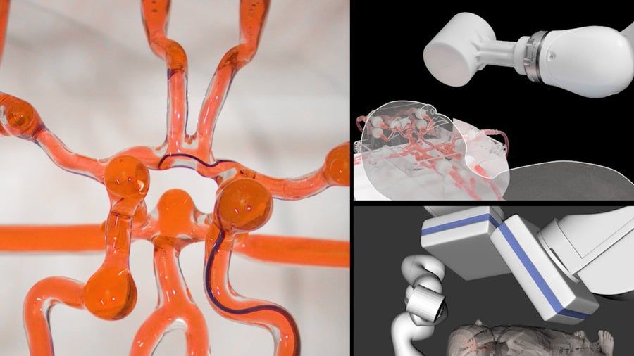 Forschende am MIT haben einen Roboter für die Schlaganfall-Diagnostik entwickelt.